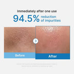 Medicube Zero Pore Blackhead Cleansing Oil 205ml